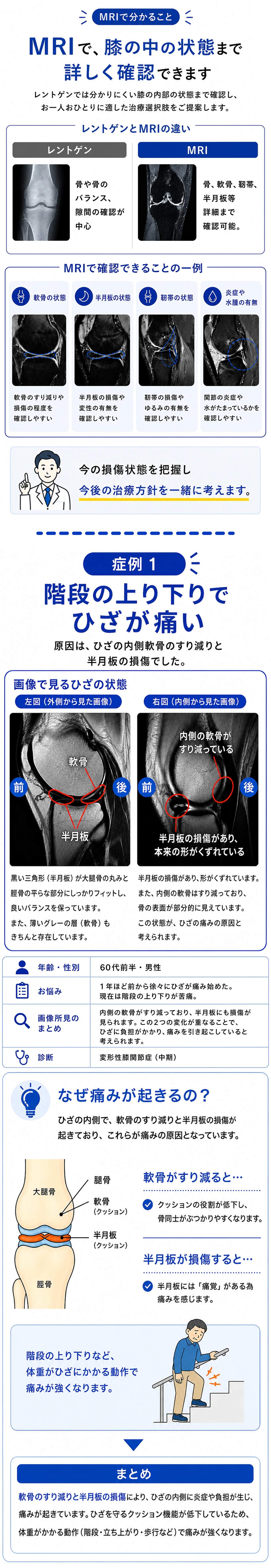 初診3300円で今の状態と次の一手が分かるMRIひざ診断の案内